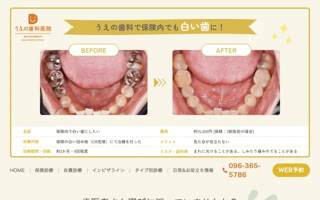 Ueno Dental Clinic - Tier Heim 1F, 52-3 Kengun Honmachi, Higashi-ku, Kumamoto, Kumamoto